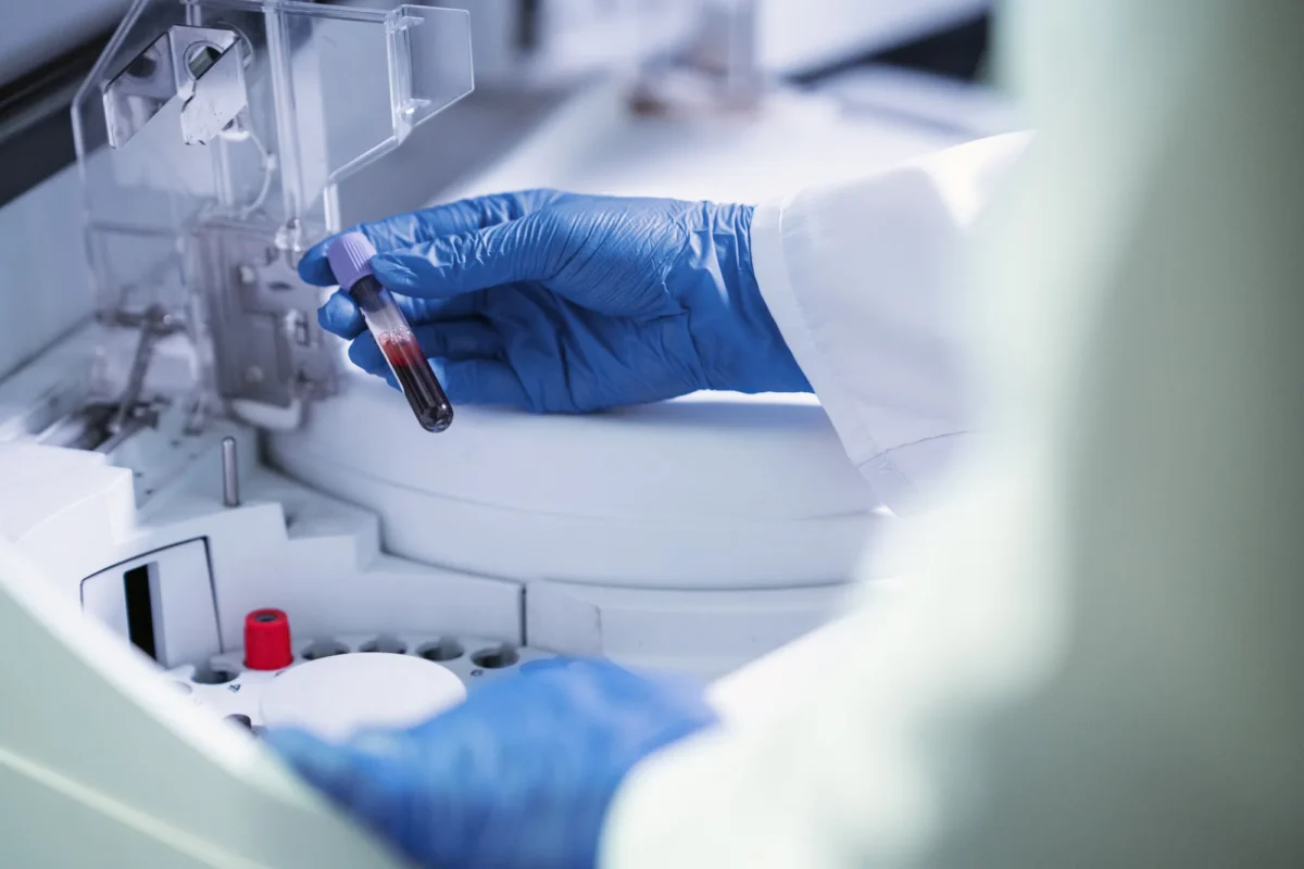 laboratorijske-analize-featured-image-1200x800.webp